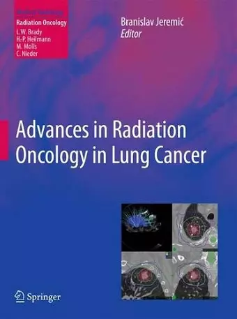 Advances in Radiation Oncology in Lung Cancer cover