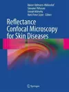 Reflectance Confocal Microscopy for Skin Diseases cover