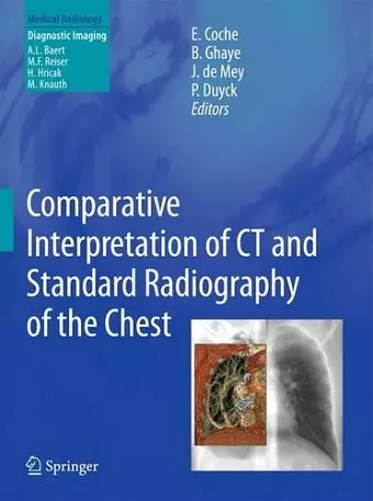 Comparative Interpretation of CT and Standard Radiography of the Chest cover