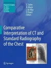 Comparative Interpretation of CT and Standard Radiography of the Chest cover