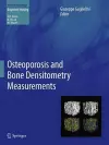 Osteoporosis and Bone Densitometry Measurements cover