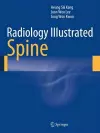 Radiology Illustrated: Spine cover