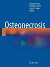 Osteonecrosis cover