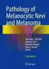 Pathology of Melanocytic Nevi and Melanoma cover