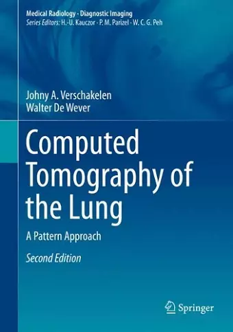 Computed Tomography of the Lung cover