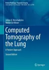 Computed Tomography of the Lung cover