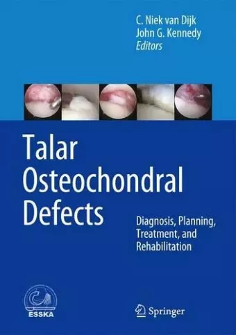 Talar Osteochondral Defects cover