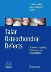 Talar Osteochondral Defects cover