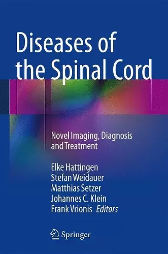 Diseases of the Spinal Cord cover