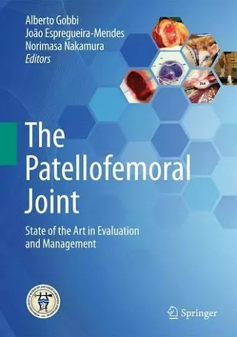 The Patellofemoral Joint cover