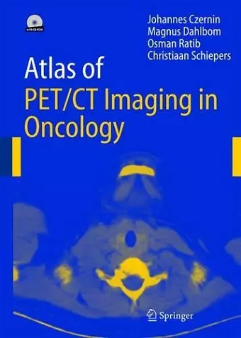 Atlas of PET/CT Imaging in Oncology cover