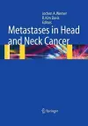 Metastases in Head and Neck Cancer cover