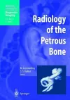 Radiology of the Petrous Bone cover