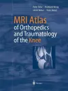 MRI Atlas of Orthopedics and Traumatology of the Knee cover