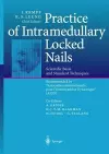 Practice of Intramedullary Locked Nails cover