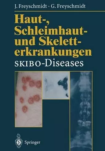 Haut-, Schleimhaut- und Skeletterkrankungen SKIBO-Diseases cover