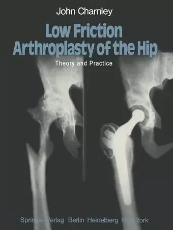 Low Friction Arthroplasty of the Hip cover