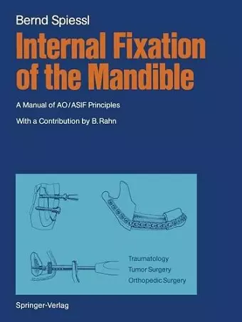 Internal Fixation of the Mandible cover