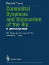 Congenital Dysplasia and Dislocation of the Hip in Children and Adults cover