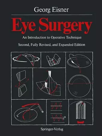 Eye Surgery cover