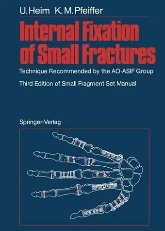 Internal Fixation of Small Fractures cover