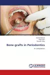 Bone grafts in Periodontics cover