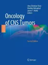 Oncology of CNS Tumors cover