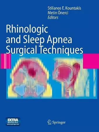 Rhinologic and Sleep Apnea Surgical Techniques cover