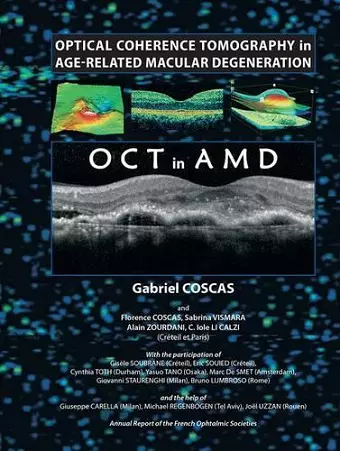 Optical Coherence Tomography in Age-Related Macular Degeneration cover