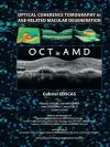 Optical Coherence Tomography in Age-Related Macular Degeneration cover