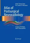 Atlas of Postsurgical Neuroradiology cover