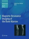 Magnetic Resonance Imaging of the Bone Marrow cover