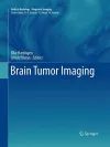Brain Tumor Imaging cover