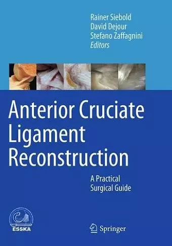 Anterior Cruciate Ligament Reconstruction cover