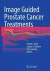 Image Guided Prostate Cancer Treatments cover