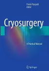 Cryosurgery cover