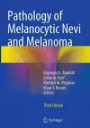 Pathology of Melanocytic Nevi and Melanoma cover