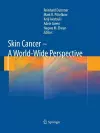 Skin Cancer - A World-Wide Perspective cover