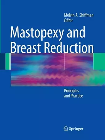 Mastopexy and Breast Reduction cover