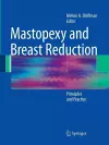 Mastopexy and Breast Reduction cover