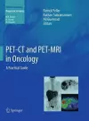 PET-CT and PET-MRI in Oncology cover