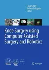 Knee Surgery using Computer Assisted Surgery and Robotics cover