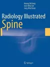 Radiology Illustrated: Spine cover