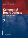 Congenital Heart Defects. Decision Making for Surgery cover