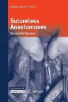 Sutureless Anastomoses cover