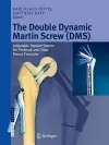 The Double Dynamic Martin Screw (DMS) cover
