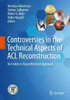 Controversies in the Technical Aspects of ACL Reconstruction cover