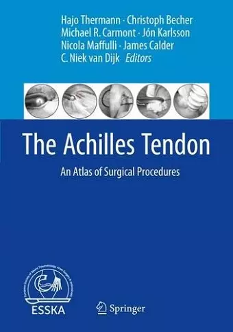 The Achilles Tendon cover