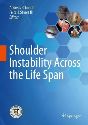 Shoulder Instability Across the Life Span cover