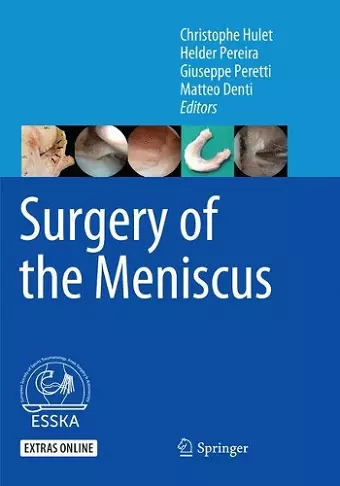 Surgery of the Meniscus cover